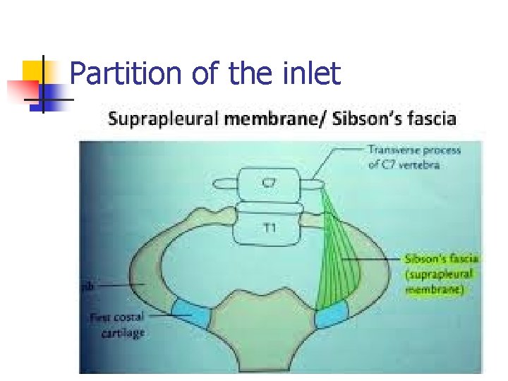 Partition of the inlet 