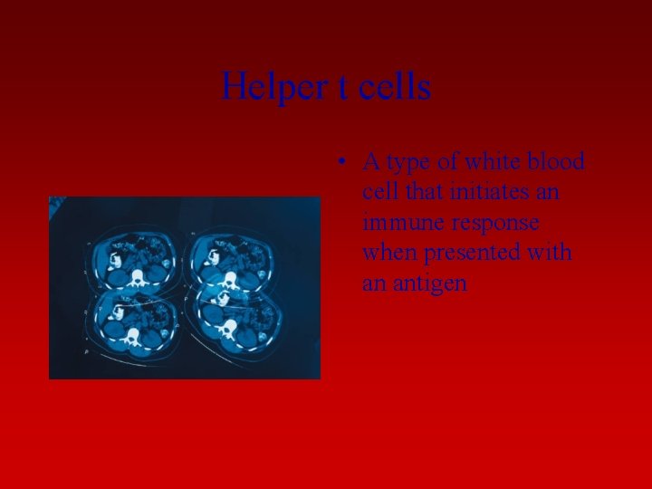 Helper t cells • A type of white blood cell that initiates an immune