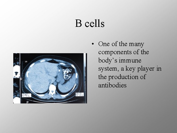 B cells • One of the many components of the body’s immune system, a