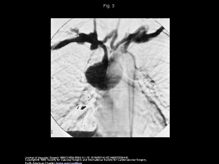 Fig. 3 Journal of Vascular Surgery 1995 21505 -509 DOI: (10. 1016/S 0741 -5214(95)70294