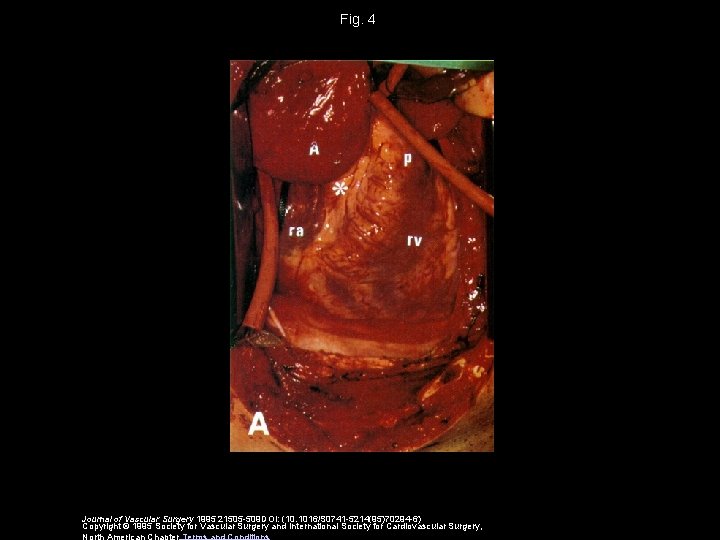 Fig. 4 Journal of Vascular Surgery 1995 21505 -509 DOI: (10. 1016/S 0741 -5214(95)70294