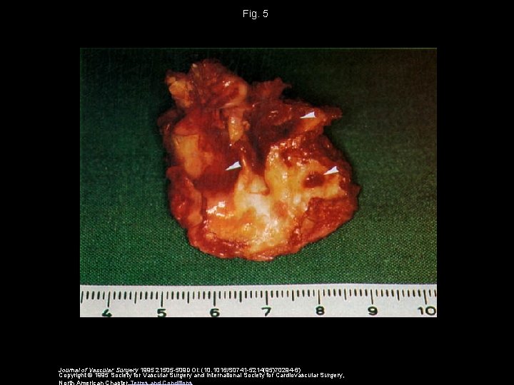 Fig. 5 Journal of Vascular Surgery 1995 21505 -509 DOI: (10. 1016/S 0741 -5214(95)70294