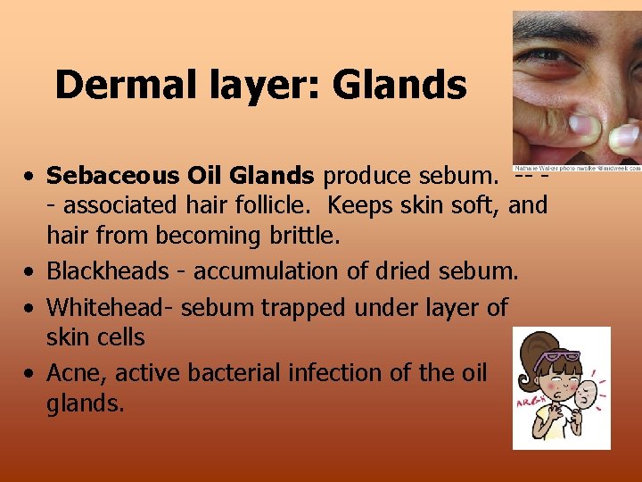 Dermal layer: Glands • Sebaceous Oil Glands produce sebum. -- - associated hair follicle.