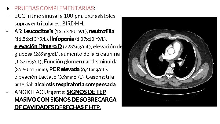 ● PRUEBAS COMPLEMENTARIAS: - ECG: ritmo sinusal a 100 lpm. Extrasístoles supraventriculares. BIRDHH. -