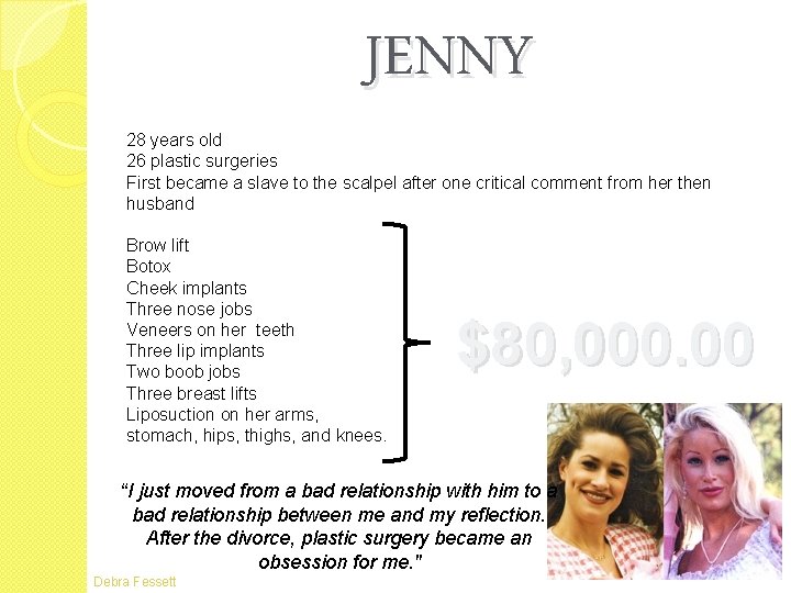 JENNY 28 years old 26 plastic surgeries First became a slave to the scalpel JENNY 28 years old 26 plastic surgeries First became a slave to the scalpel