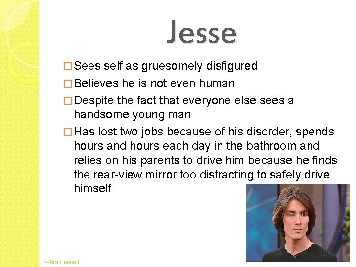 Jesse � Sees self as gruesomely disfigured � Believes he is not even human Jesse � Sees self as gruesomely disfigured � Believes he is not even human