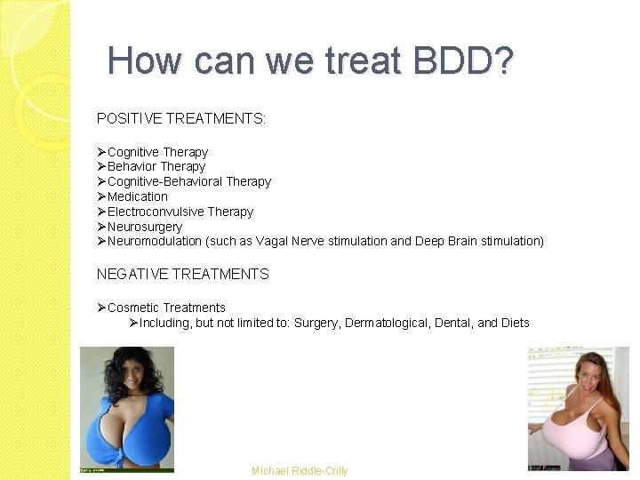 How can we treat BDD? POSITIVE TREATMENTS: ØCognitive Therapy ØBehavior Therapy ØCognitive-Behavioral Therapy ØMedication How can we treat BDD? POSITIVE TREATMENTS: ØCognitive Therapy ØBehavior Therapy ØCognitive-Behavioral Therapy ØMedication