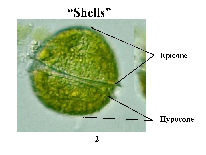“Shells” Epicone Hypocone 2 