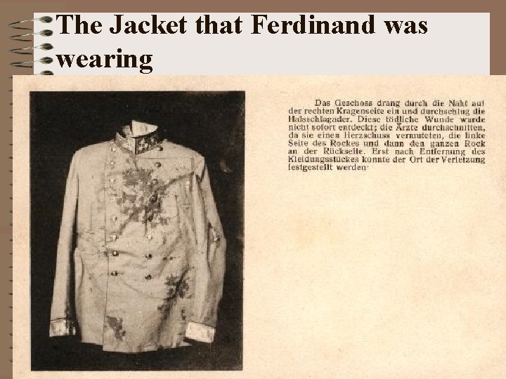 The Jacket that Ferdinand was wearing 