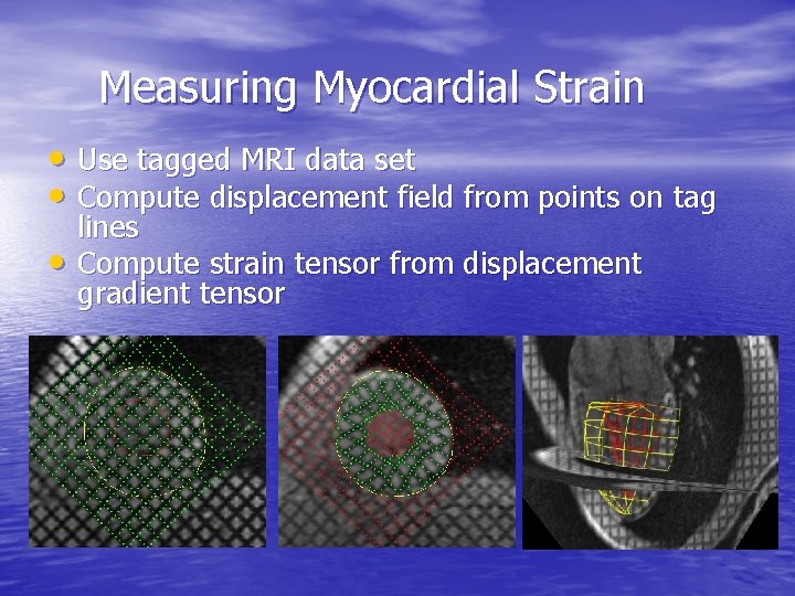 Measuring Myocardial Strain • Use tagged MRI data set • Compute displacement field from