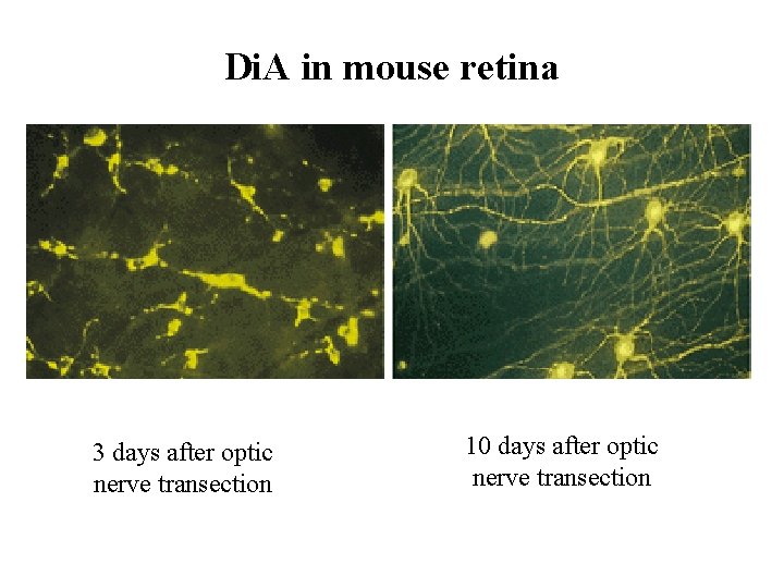 Di. A in mouse retina 3 days after optic nerve transection 10 days after Di. A in mouse retina 3 days after optic nerve transection 10 days after