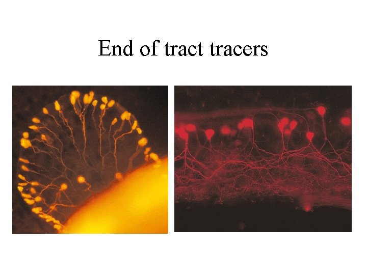 End of tract tracers End of tract tracers