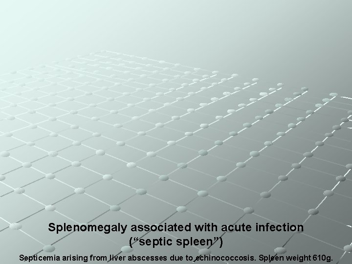 Splenomegaly associated with acute infection (“septic spleen”) Septicemia arising from liver abscesses due to