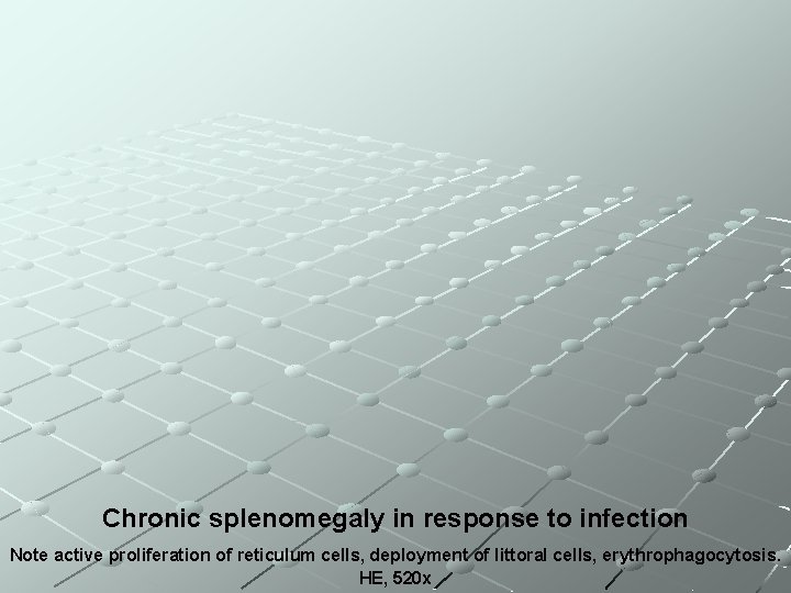 Chronic splenomegaly in response to infection Note active proliferation of reticulum cells, deployment of