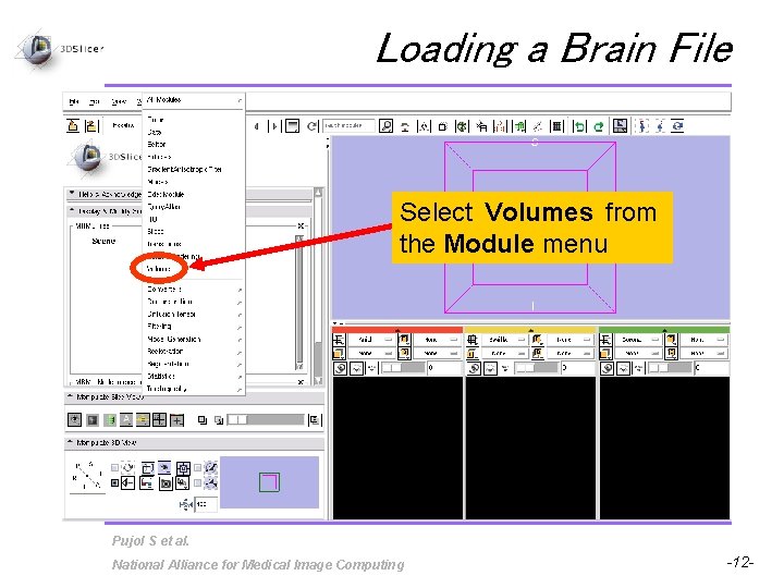Loading a Brain File Select Volumes from the Module menu Pujol S et al.