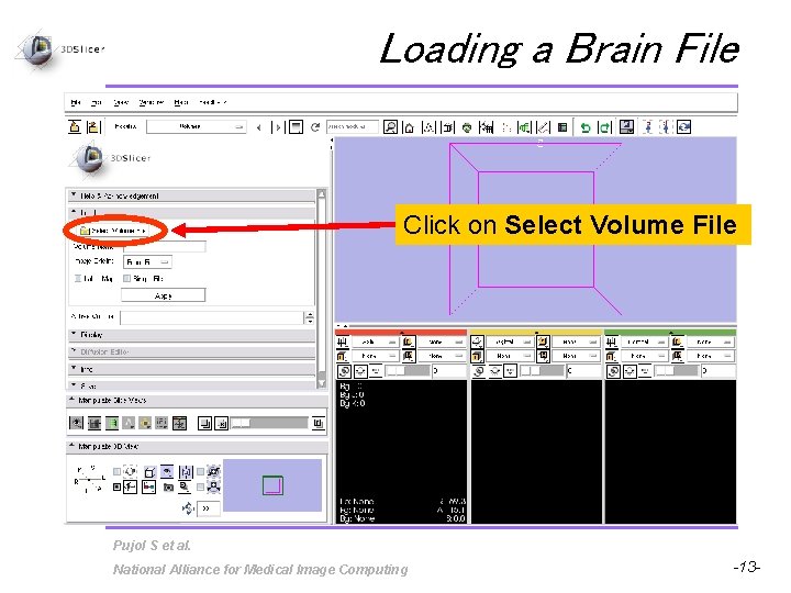 Loading a Brain File Click on Select Volume File Pujol S et al. National