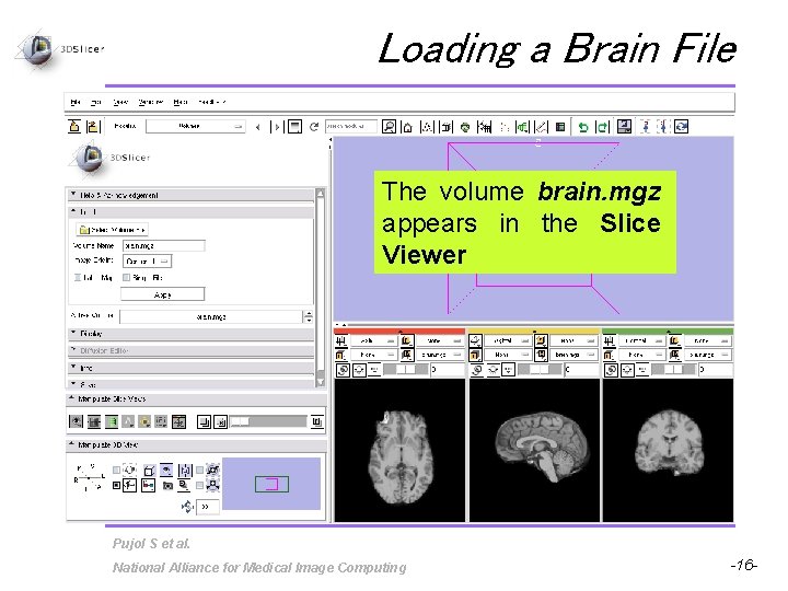 Loading a Brain File The volume brain. mgz appears in the Slice Viewer Pujol