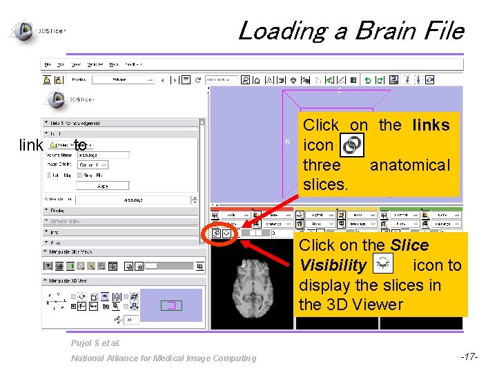 Loading a Brain File link to Click on the links icon three anatomical slices.