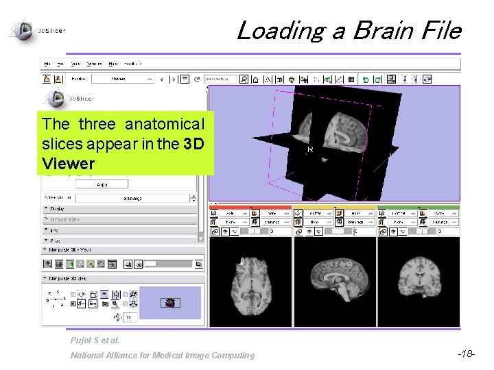 Loading a Brain File The three anatomical slices appear in the 3 D Viewer
