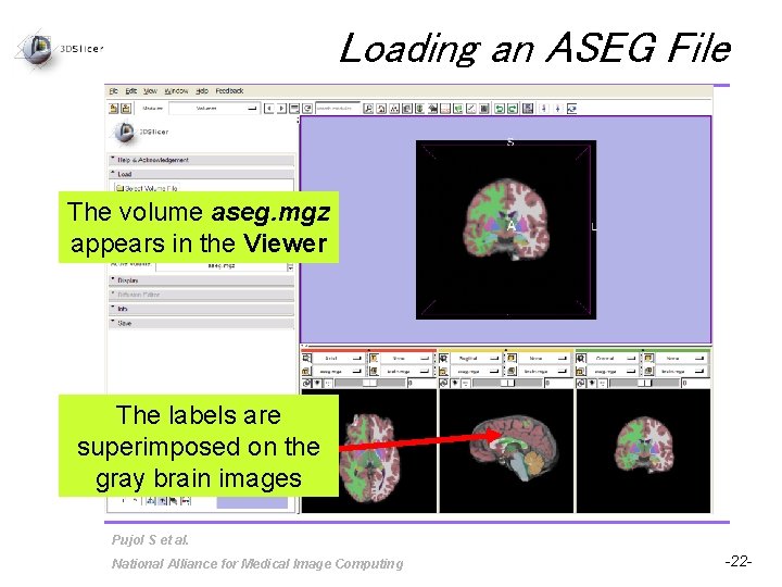 Loading an ASEG File The volume aseg. mgz appears in the Viewer The labels