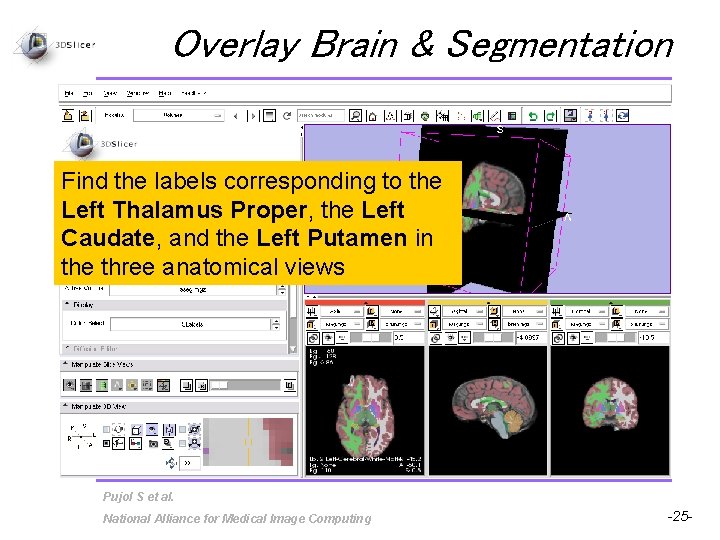 Overlay Brain & Segmentation Find the labels corresponding to the Left Thalamus Proper, the