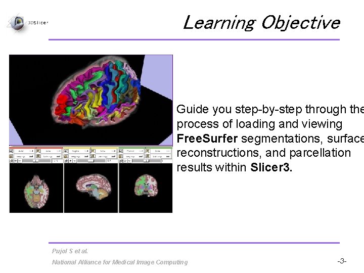 Learning Objective Guide you step-by-step through the process of loading and viewing Free. Surfer