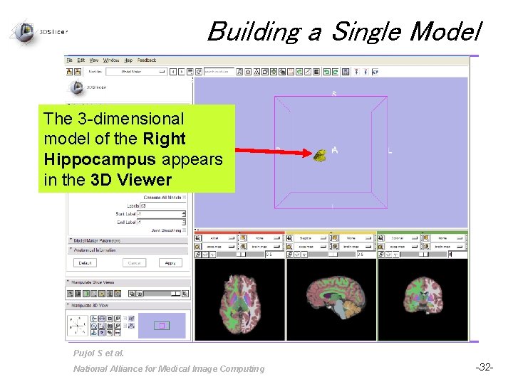 Building a Single Model The 3 -dimensional model of the Right Hippocampus appears in