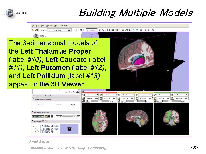 Building Multiple Models The 3 -dimensional models of the Left Thalamus Proper (label #10),