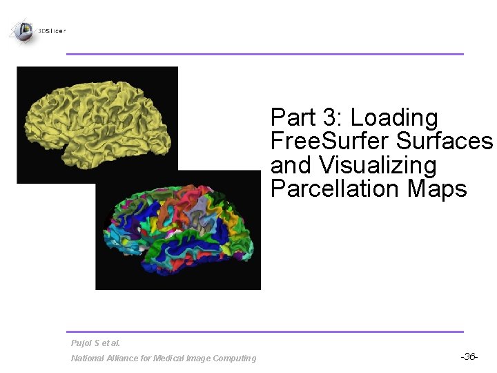 Part 3: Loading Free. Surfer Surfaces and Visualizing Parcellation Maps Pujol S et al.