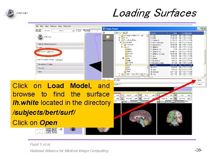 Loading Surfaces Click on Load Model, and browse to find the surface lh. white