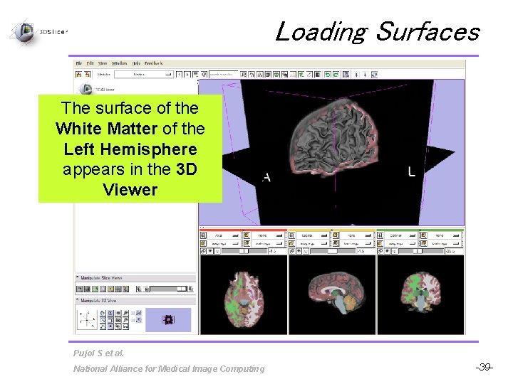 Loading Surfaces The surface of the White Matter of the Left Hemisphere appears in