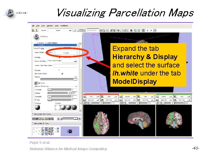 Visualizing Parcellation Maps Expand the tab Hierarchy & Display and select the surface lh.
