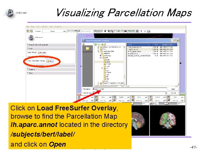 Visualizing Parcellation Maps Click on Load Free. Surfer Overlay, browse to find the Parcellation