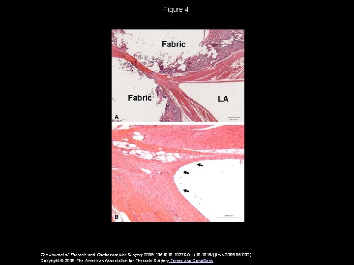 Figure 4 The Journal of Thoracic and Cardiovascular Surgery 2008 1361019 -1027 DOI: (10.