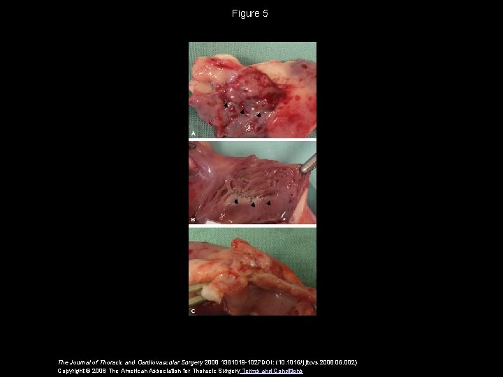 Figure 5 The Journal of Thoracic and Cardiovascular Surgery 2008 1361019 -1027 DOI: (10.