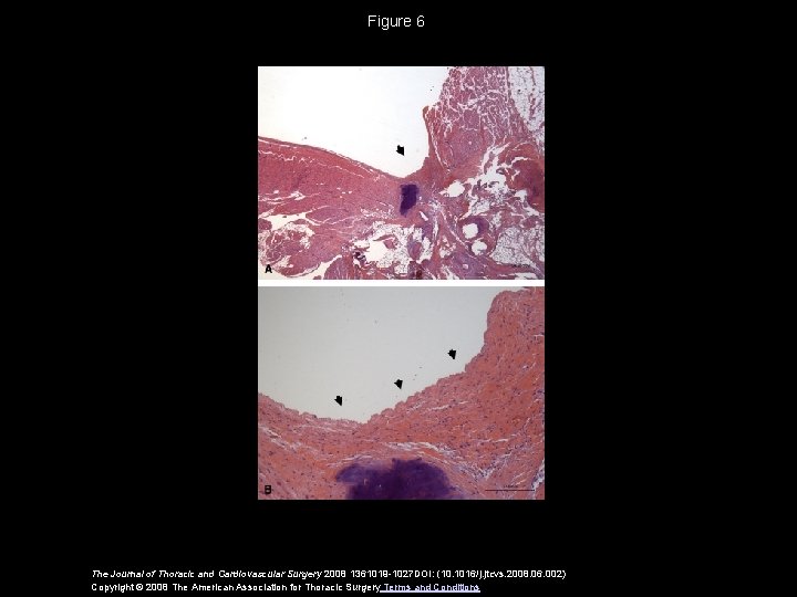 Figure 6 The Journal of Thoracic and Cardiovascular Surgery 2008 1361019 -1027 DOI: (10.