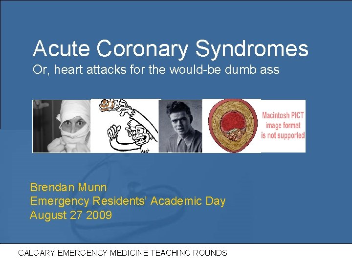 Acute Coronary Syndromes Or, heart attacks for the would-be dumb ass Brendan Munn Emergency