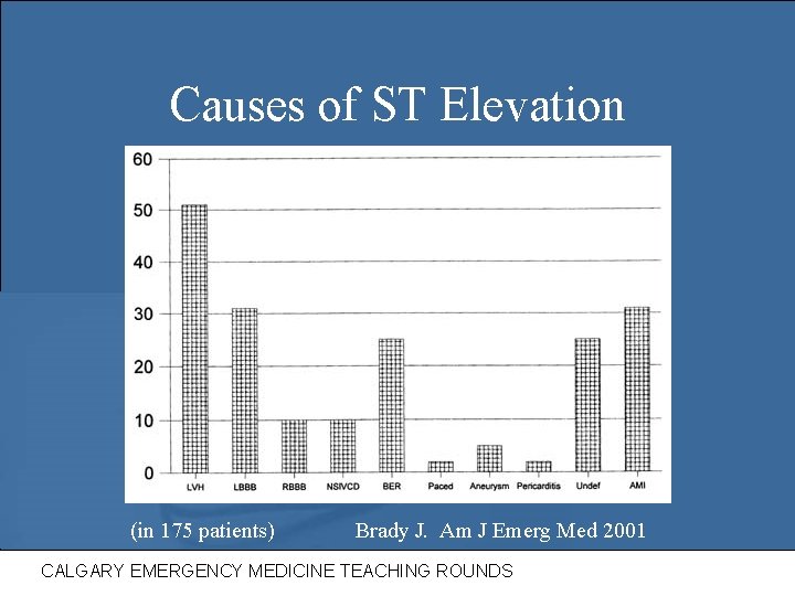 Causes of ST Elevation (in 175 patients) Brady J. Am J Emerg Med 2001