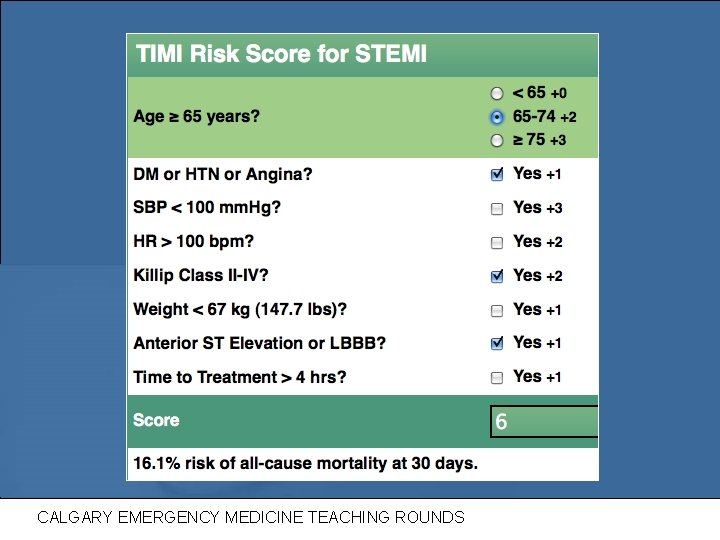 TIMI score CALGARY EMERGENCY MEDICINE TEACHING ROUNDS 