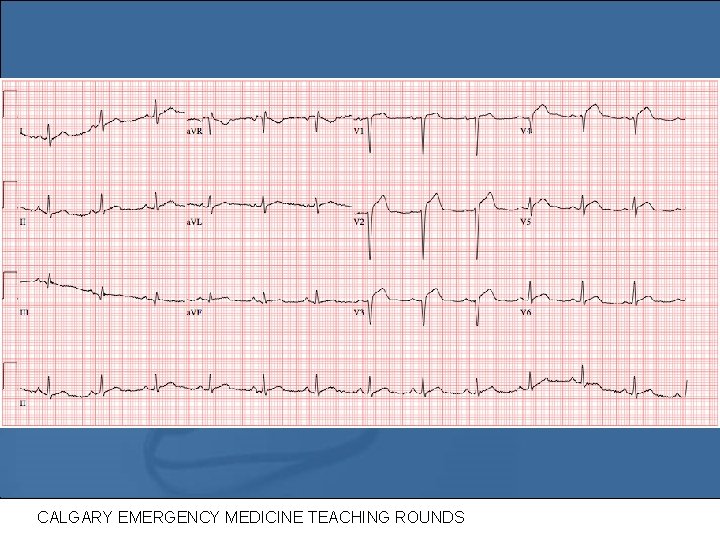 CALGARY EMERGENCY MEDICINE TEACHING ROUNDS 