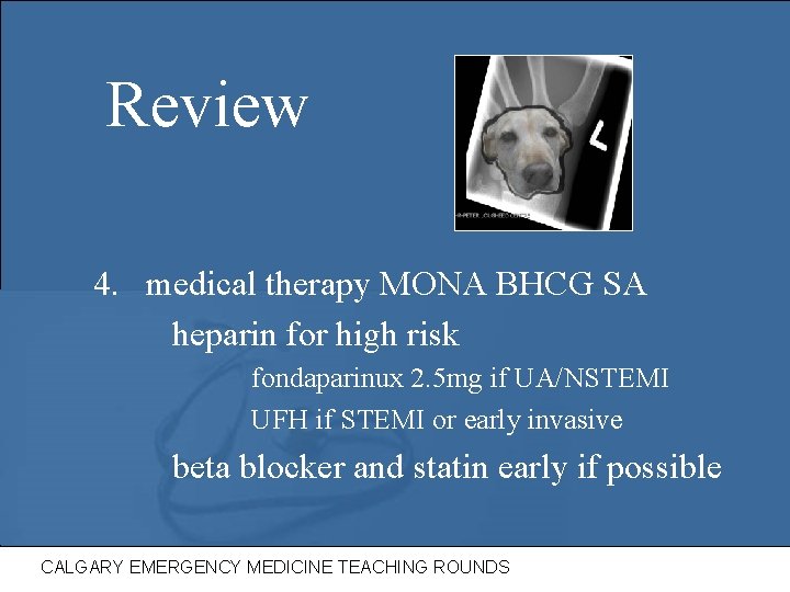 Review 4. medical therapy MONA BHCG SA heparin for high risk fondaparinux 2. 5