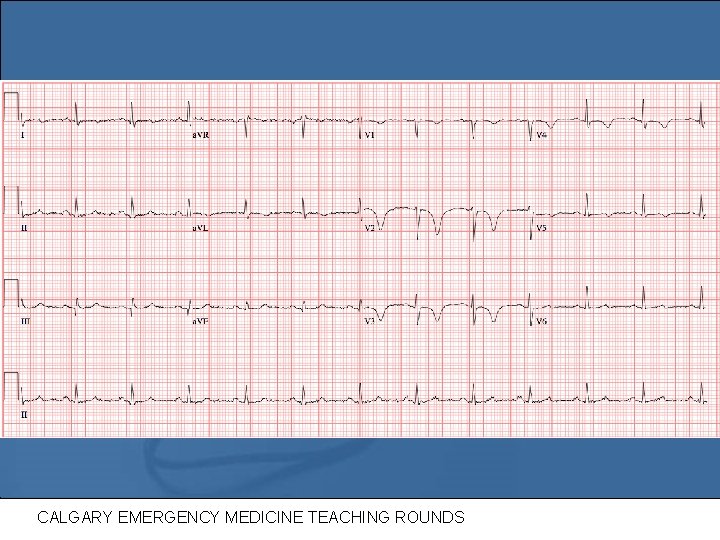 CALGARY EMERGENCY MEDICINE TEACHING ROUNDS CALGARY EMERGENCY MEDICINE TEACHING ROUNDS