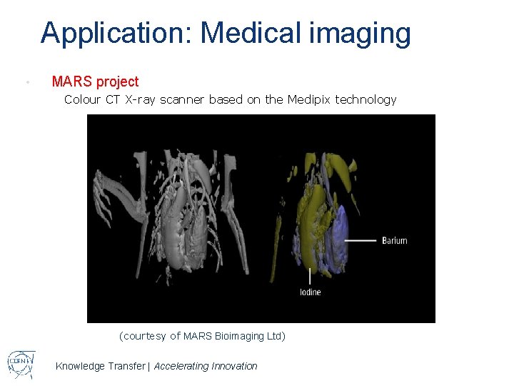 Application: Medical imaging • MARS project Colour CT X-ray scanner based on the Medipix