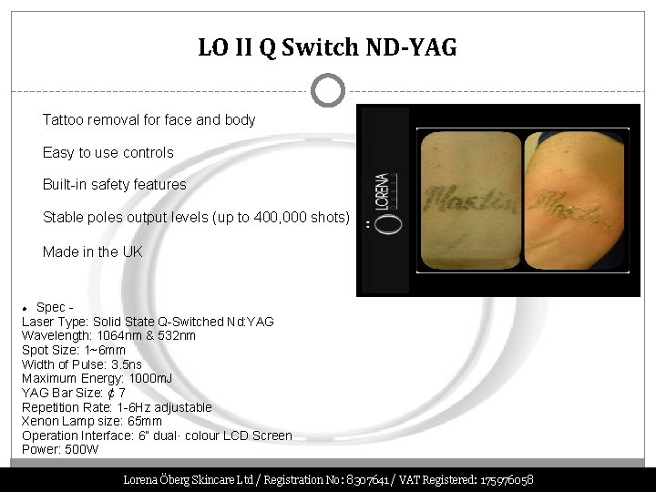 LO II Q Switch ND-YAG Tattoo removal for face and body Easy to use