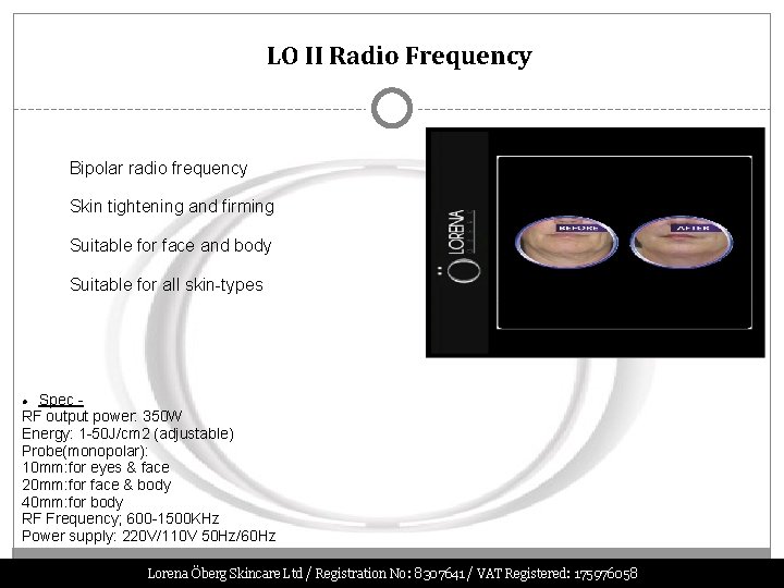 LO II Radio Frequency Bipolar radio frequency Skin tightening and firming Suitable for face