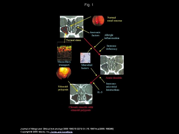 Fig. 1 Journal of Allergy and Clinical Immunology 2000 106213 -227 DOI: (10. 1067/mai.