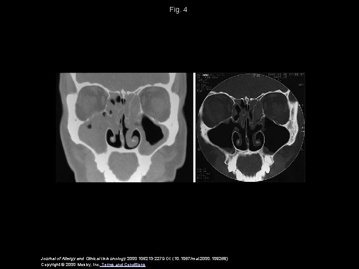 Fig. 4 Journal of Allergy and Clinical Immunology 2000 106213 -227 DOI: (10. 1067/mai.