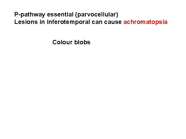 P-pathway essential (parvocellular) Lesions in inferotemporal can cause achromatopsia Colour blobs 