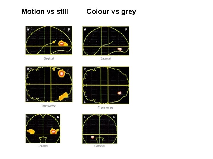 Motion vs still Colour vs grey 