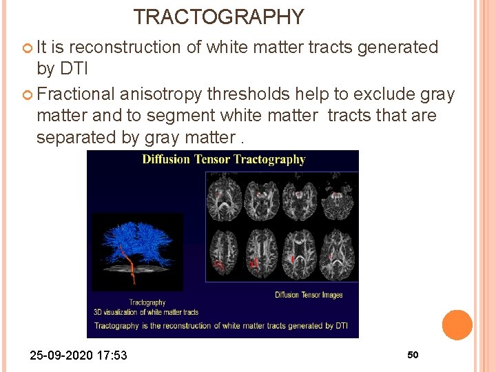 TRACTOGRAPHY It is reconstruction of white matter tracts generated by DTI Fractional anisotropy thresholds